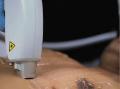 http://www.touchlocal.com/business/list/bid/7021032
Provides information on various hair removal methods such as laser hair removal electrolysis threading and waxing.