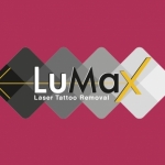 LuMax Laser Tattoo Removal Ltd