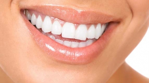 Teeth Whitening Birmingham