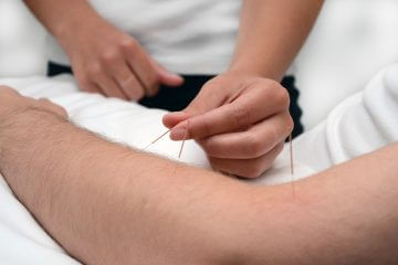 Physiotherapy, Acupuncture, Injections, Sports Massage and more
