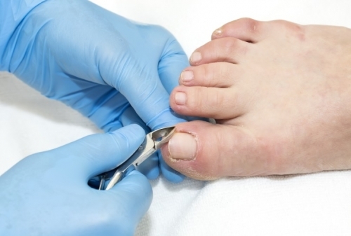 Val Anderson - Smart Foot Care Ipswich - Foot Health Practitioner